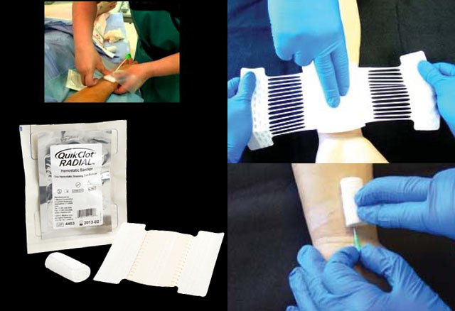 Quikclot_Radial_Hemostatic_Bandage_interventional_bandage.jpg